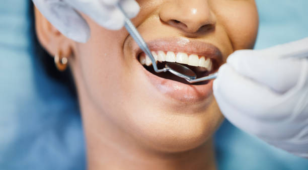 Best Urgent Tooth Repair  in Newellton, LA