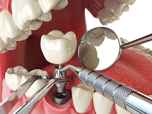 Best Tooth Pain Emergency Relief  in Newellton, LA